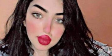 نجاحات رائعة للموديل شمس ياسر