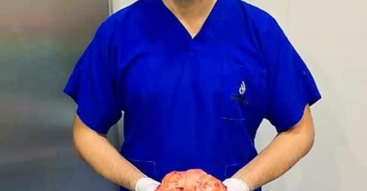 تعرف علي الأعراض الشائعة للأورام الليفية وعوامل الخطورة التي تزيد فرص الأصابة