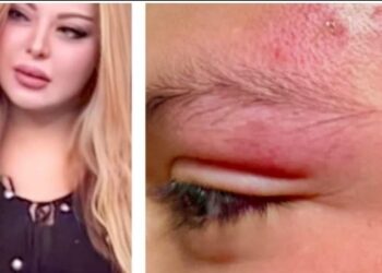 تعدى على نجل الأعلاميه شذا شعبان فى الساحل الشمالى مارينا ٢ على يد طالب بكليه الحقوق