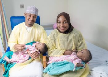 التصاق من نوع نادر “أمفالوإيشيوباگوس” .. “سمارا و سمرا” توأمتان سياميتان تتشاركان منطقة الحوض