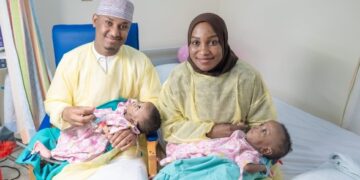 التصاق من نوع نادر “أمفالوإيشيوباگوس” .. “سمارا و سمرا” توأمتان سياميتان تتشاركان منطقة الحوض