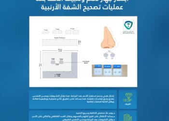 ابتكار طبي في “تجمع القصيم” يُحسّن حياة الأطفال بعد عمليات الشفة الأرنبية دون جراحة إضافية