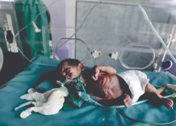 دراسة مقارنة بين غزة واليمن .. أجنة مشوهة وعالم بلا ضمير بفعل  الأسلحة المحرمة دوليا