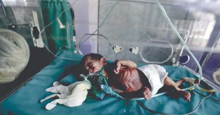 دراسة مقارنة بين غزة واليمن .. أجنة مشوهة وعالم بلا ضمير بفعل الأسلحة المحرمة دوليا