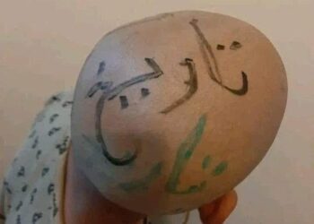 عقاب أم إذلال؟ حين يتحول الأب من سندٍ إلى سببٍ للانكسار