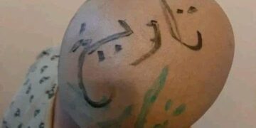 عقاب أم إذلال؟ حين يتحول الأب من سندٍ إلى سببٍ للانكسار