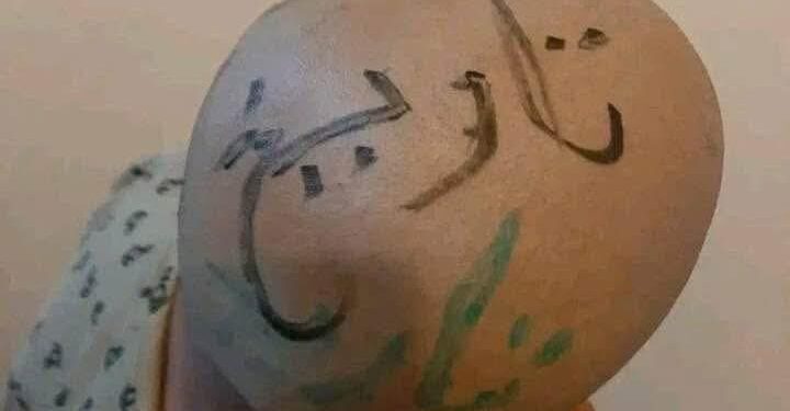 عقاب أم إذلال؟ حين يتحول الأب من سندٍ إلى سببٍ للانكسار