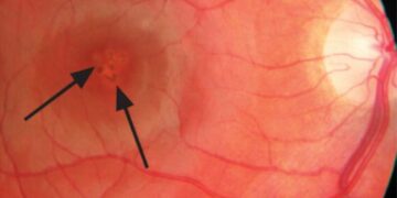 د. محمد نادر اختصاصي طب وجراحة العيون بمستشفيات الحمادي.. في حديث عن