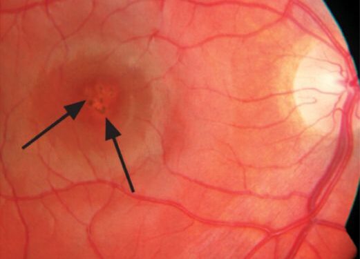 د. محمد نادر اختصاصي طب وجراحة العيون بمستشفيات الحمادي.. في حديث عن
